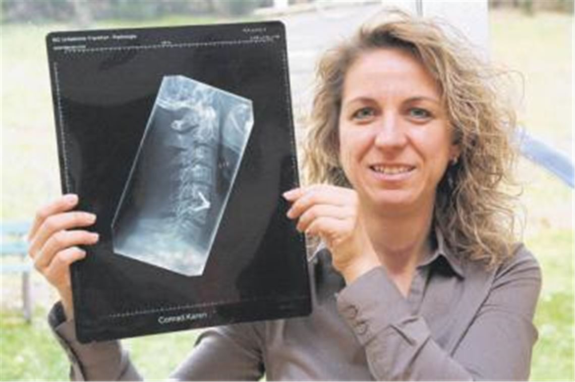 Auf dem Röntgenbild gut zusehen: Eine flexible Metallklammer hält die Halswirbel C5 und C6 zuammen, erlaubt aber Beweglichkeit. Ohne die neue Methode Zero-P, die nur an zwei Kliniken in Deutschland angewandt wird, wären die beiden Wirbel nun steif miteinander verbunden.
Foto: Eigner