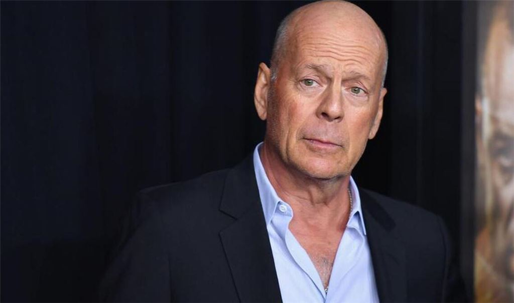 Bei Schauspieler Bruce Willis würde Leqembi, wie bei vielen anderen Patienten, nicht wirken: Er hat frontotemporale Demenz – und kein Alzheimer. Zudem ist seine Krankheit weit fortgeschritten.