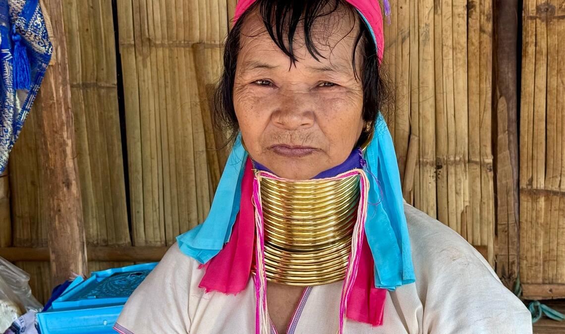 Bis zum 45. Lebensjahr kommen immer neue Ringe hinzu.