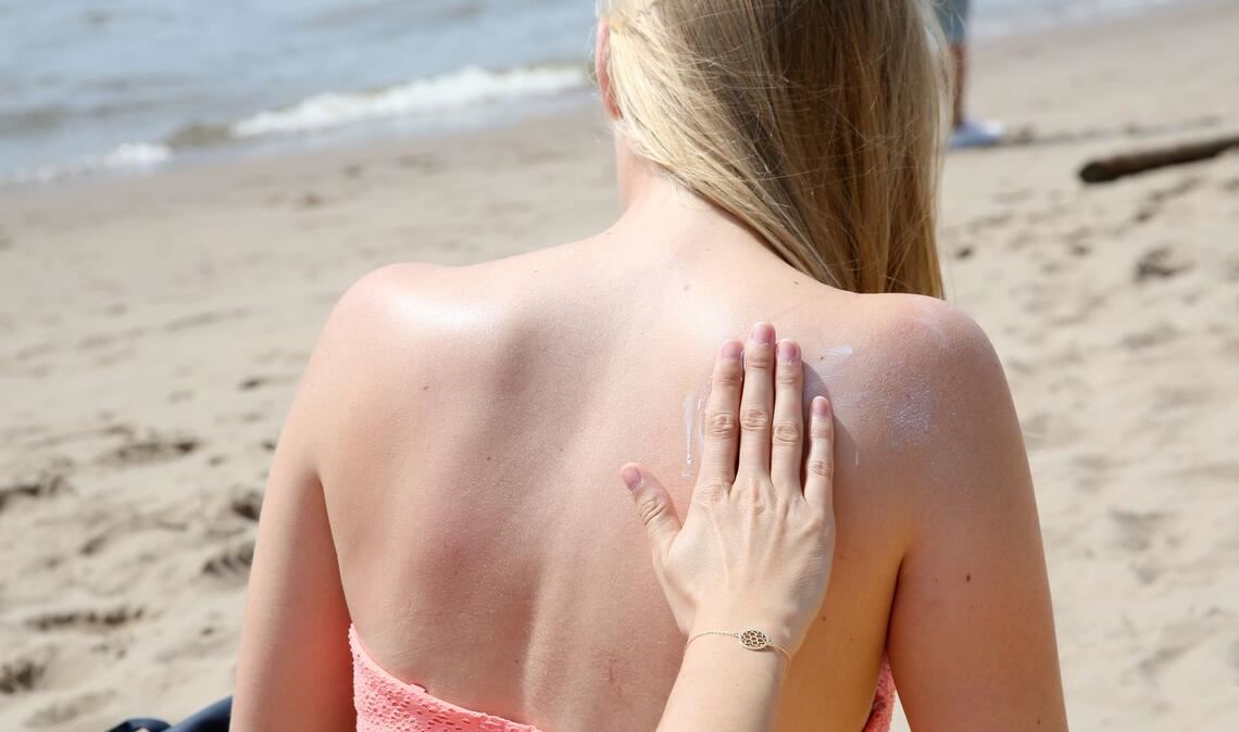 "Das Risiko, einen Sonnenbrand zu bekommen, ist abhängig vom Sonnenstand und in den Sommermonaten von Juni bis August sowie in der Mittagszeit zwischen 11 und 15 Uhr besonders hoch", sagte der Dermatologe Mark Berneburg der Deutschen Presse-Agentur.