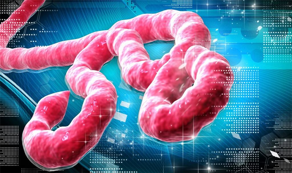 Der Ebola-Erreger wird vor allem durch Körperflüssigkeiten wie etwa Blut, Urin, Speichel oder Erbrochenes übertragen.
