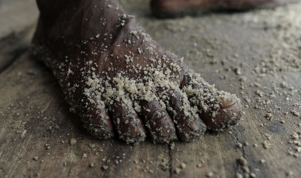 Der Fuß eines Arbeiters ist in einer Rohsalzraffinerie in Bangladesch mit Salz bedeckt.