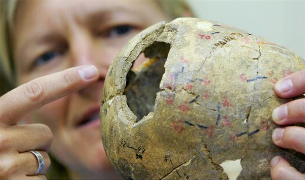 Die Blumenbachsche Schädelsammlung befindet sich im Zentrum Anatomie der Universitätsmedizin Göttingen. Die Sammlung wurde im 19. Jahrhundert von Johann Friedrich Blumenbach (1752-1840) begründet. Sie ist damit die älteste Schädelsammlung Deutschlands (Archivbild).