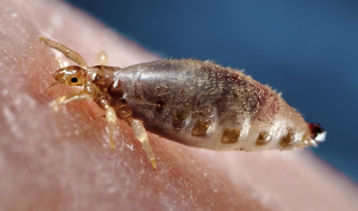 Die Kleiderlaus ist ein auf den Menschen spezialisierter blutsaugender Ektoparasit und  Überträger von Krankheitserregern wie dem Pest-Bakterium.