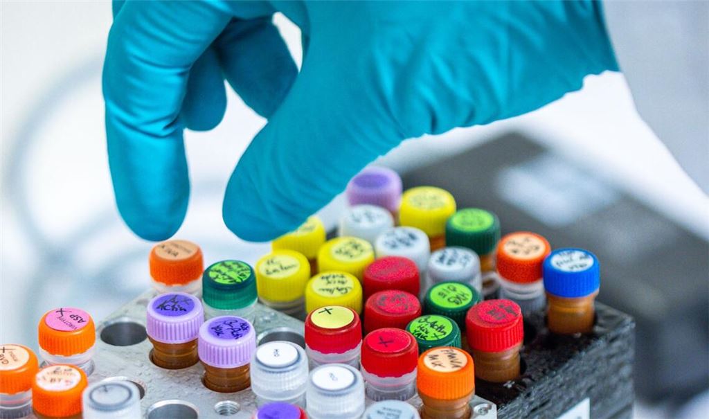 Die konkrete Ansteckungsquelle ist noch nicht bekannt (Symbolbild).