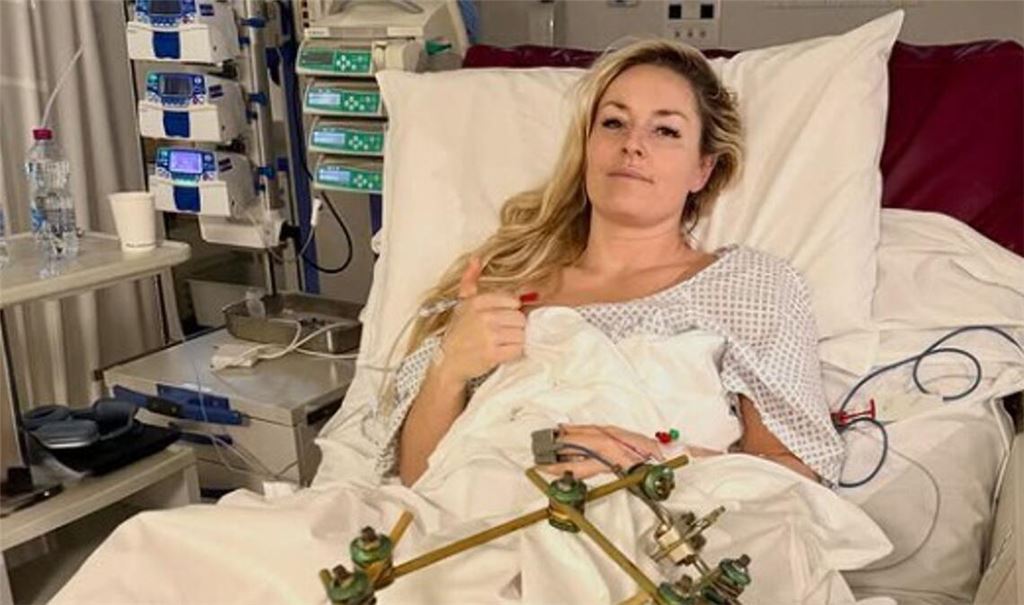 Dieses Foto postete Lindsey Vonn am Mittwoch aus dem Krankenhaus.