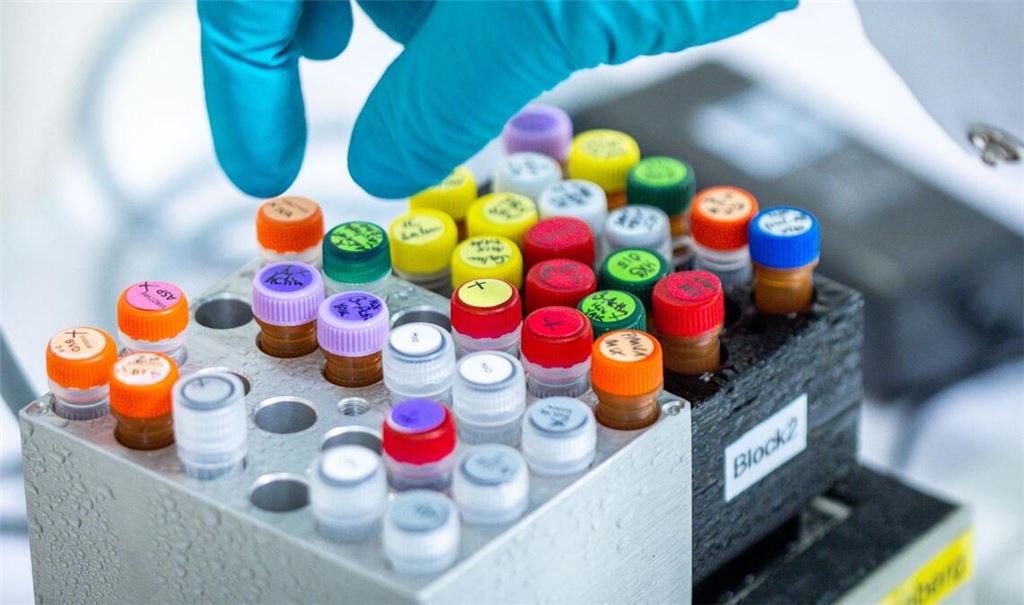 Ehec bezeichnet bestimmte krankmachende Stämme des Darm-Bakteriums, die vor allem bei Wiederkäuern wie Rindern vorkommen (Archivbild).