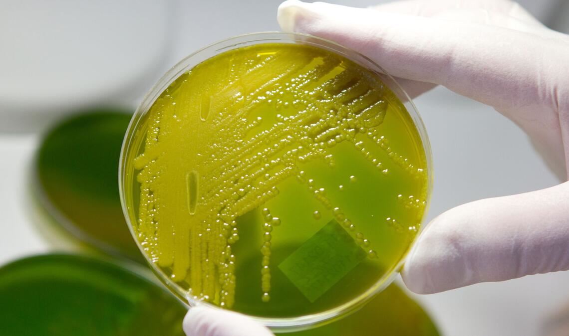 Ehec steht für enterohämorrhagische Escherichia coli und bezeichnet bestimmte krankmachende Stämme des Darm-Bakteriums, die vor allem bei Wiederkäuern wie Rindern vorkommen. (Archivbild)