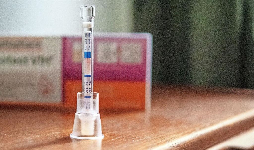 Ein HIV Selbsttest aus der Apotheke. (Symbolbild)