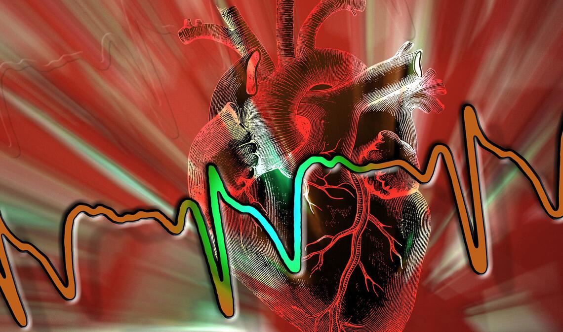 Ein  Herzinfarkt kann jederzeit in ein Kammerflimmern übergehen. Das Herz schlägt dann völlig chaotisch – über 300-mal pro Minute. Innerhalb weniger Sekunden droht der  Herzstillstand.