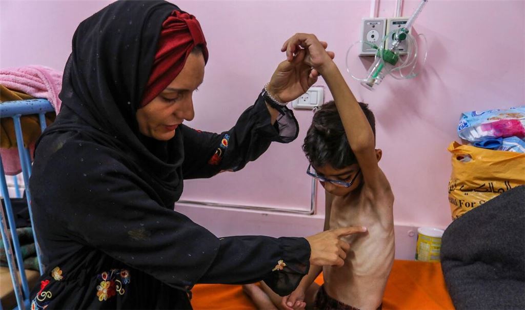 Ein palästinensisches Kind, das an schwerer Unterernährung leidet, wird von seiner Mutter im Nasser Medical Hospital gehalten. Israel hält die Grenzübergänge weiterhin geschlossen und lässt humanitäre Hilfe und Säuglingsnahrung nicht in den Gazastreifen.
