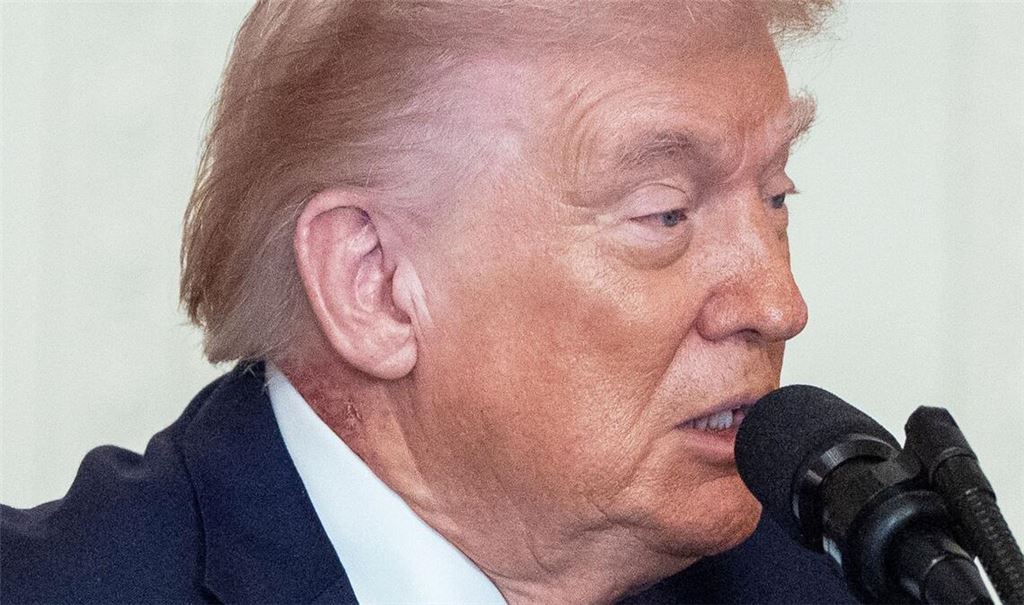 Eine Stelle an Trumps Hals hat eine Welle von Spekulationen über die Gesundheit des Präsidenten ausgelöst.