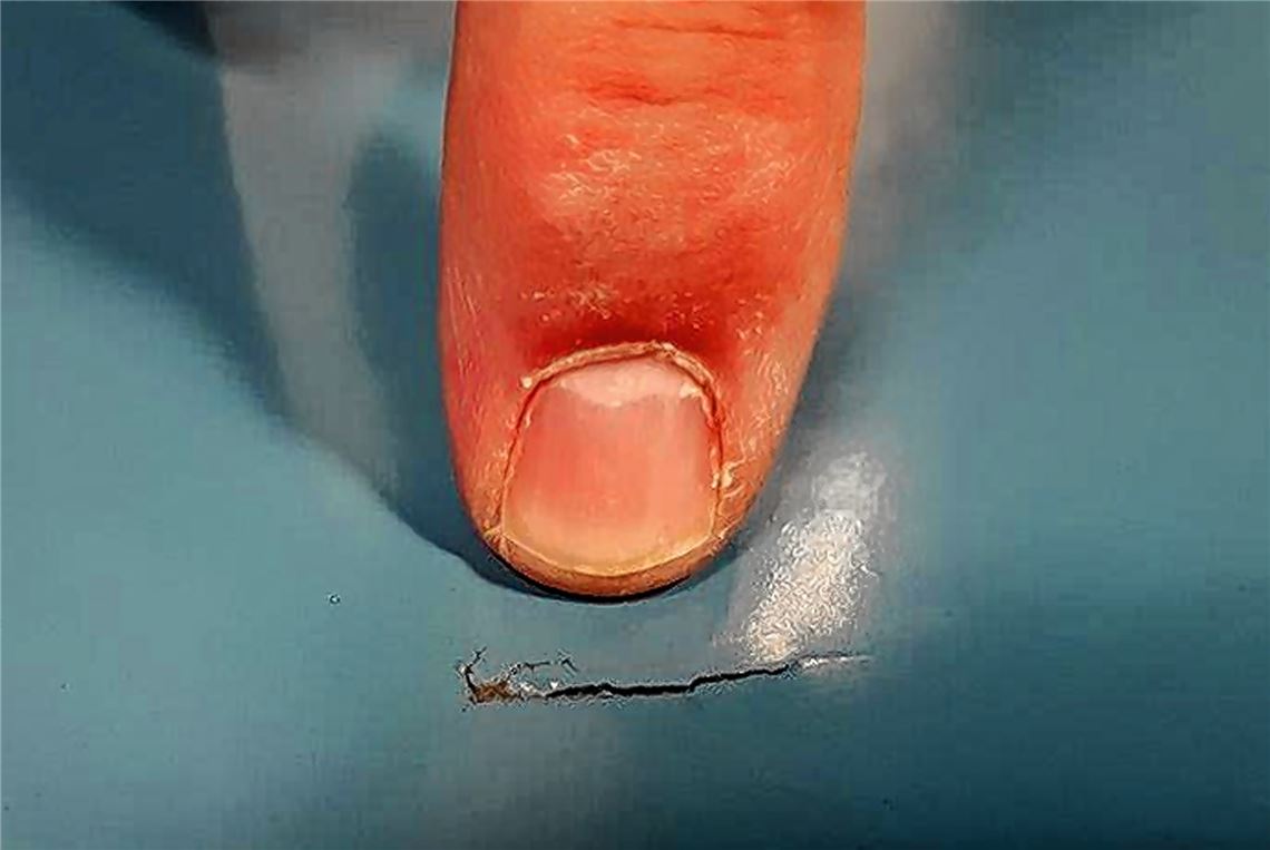 Eine von 86 in den Sommerferien entstandenen Beschädigungen auf dem Boden der an der Faustschule gelegenen Sporthalle, die deshalb vorerst gesperrt bleiben muss. Stadt Knittlingen