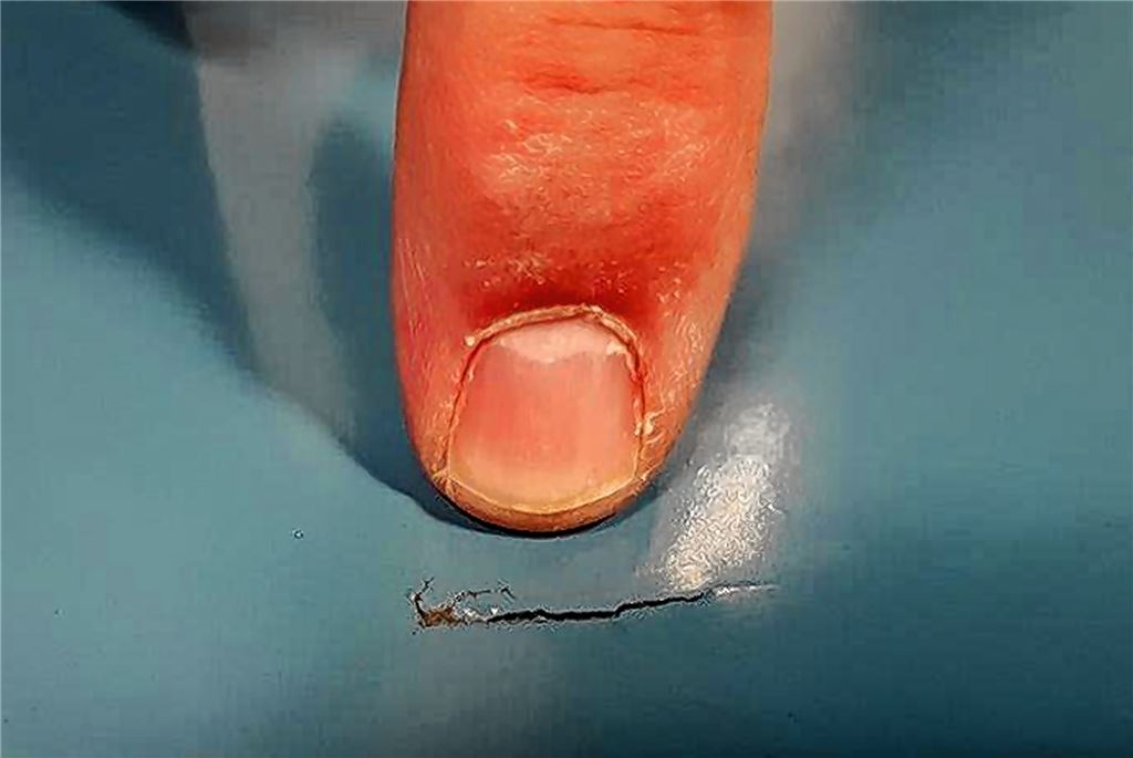 Eine von 86 in den Sommerferien entstandenen Beschädigungen auf dem Boden der an der Faustschule gelegenen Sporthalle, die deshalb vorerst gesperrt bleiben muss. Stadt Knittlingen