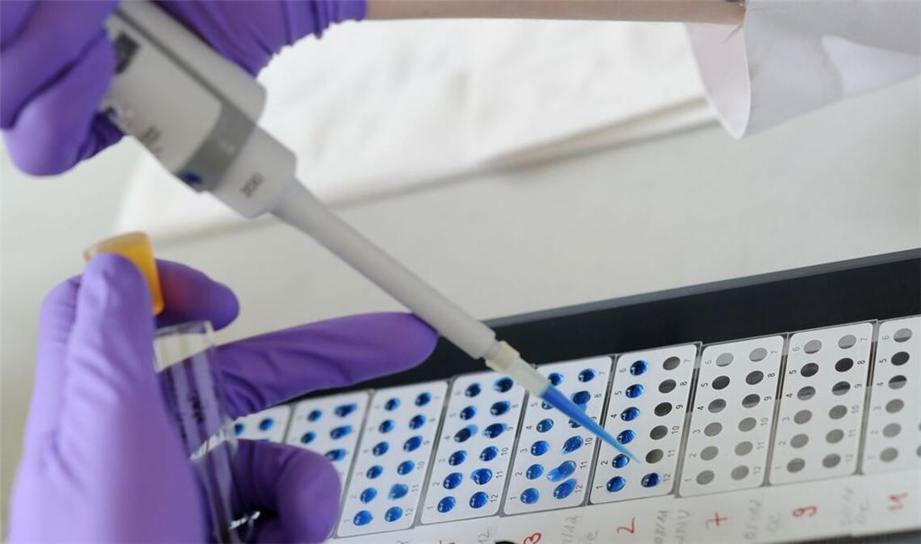 Experten in Baden-Württemberg haben sich zu dem Hantavirus geäußert. (Symbolbild)