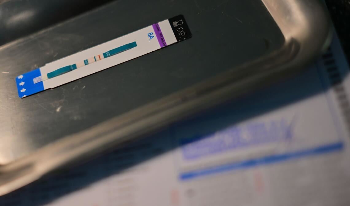 HIV-Diagnosen werden oft erst Jahre nach der Infektion gestellt. (Symbolbild)