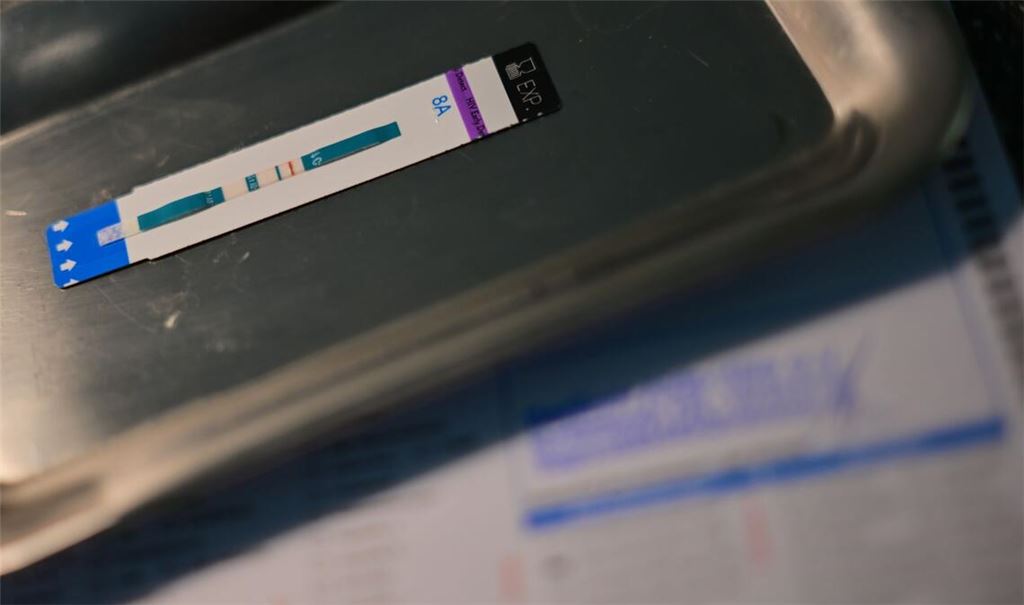 HIV-Diagnosen werden oft erst Jahre nach der Infektion gestellt. (Symbolbild)