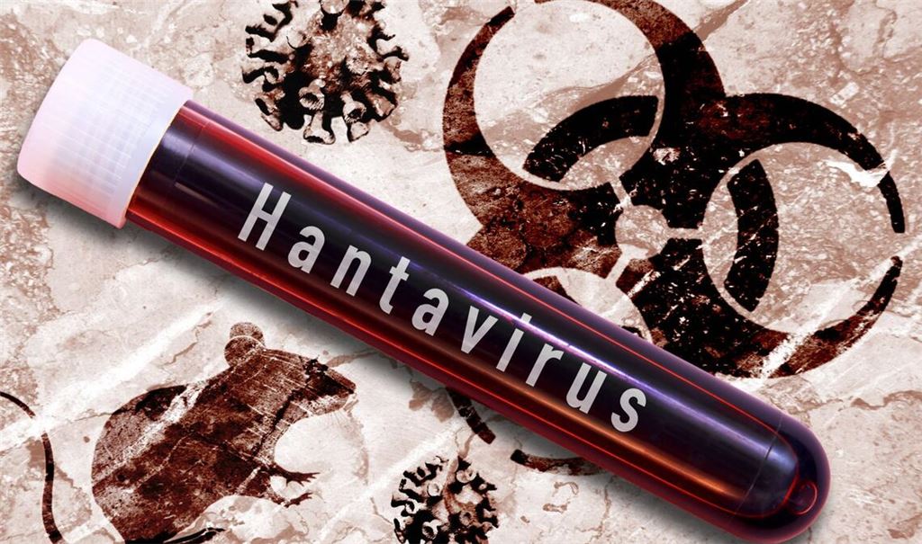 Hantavirus-Untersuchung im Labor (Montage/Symbolbild).