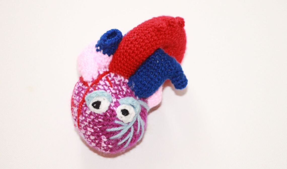 Herzmine von Bland-White-Garland - Herz mit ALCAPA-Syndrom (Anomalous Left Coronary Artery from the Pulmonary Artery). Spitzname und Lieblingstier: Alpaca. Ihr Lieblingssong: „heart attack“ von Demi Lovato. Ihre Stärke: versucht immer alles (auch jedes Sauerstoffmolekül) aus sich heraus zu holen. Ihre Schwäche: sehr schreckhaft und bekommt schnell einen Herzinfarkt