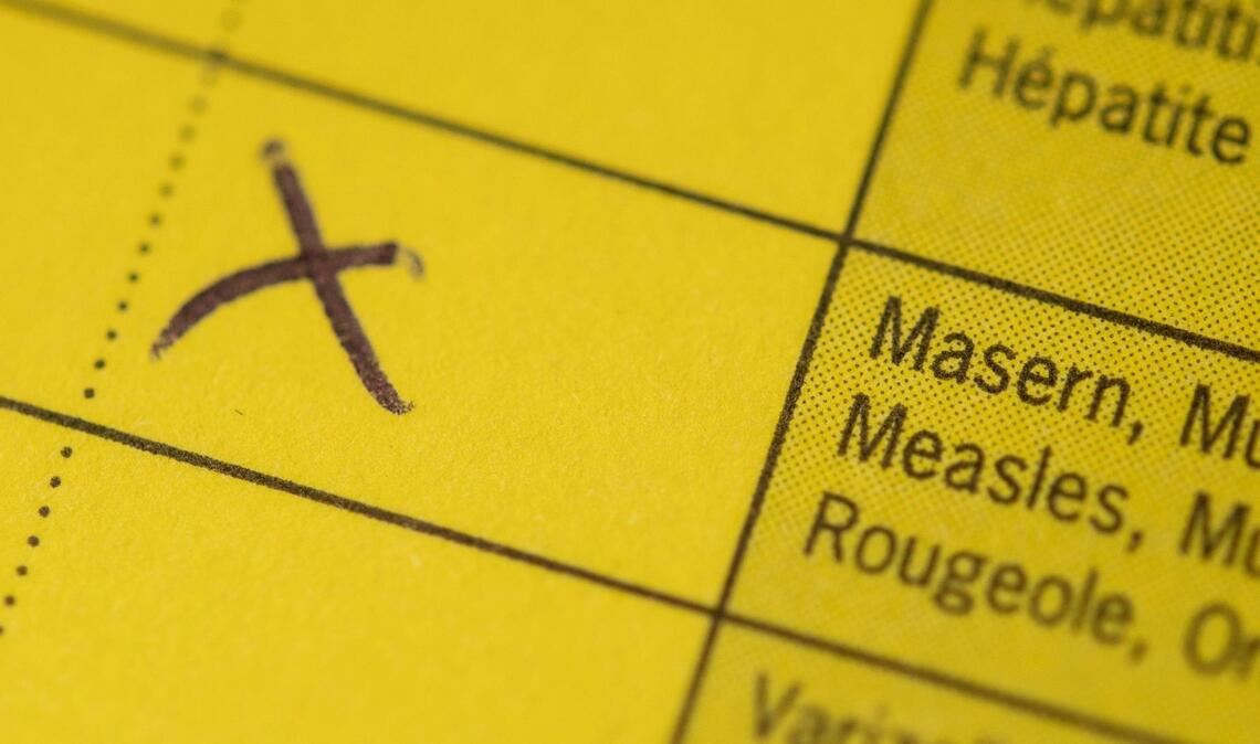 In Karlsruhe ist es zu einem Masernausbruch gekommen. (Symbolbild)