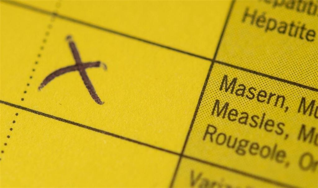 In Karlsruhe ist es zu einem Masernausbruch gekommen. (Symbolbild)