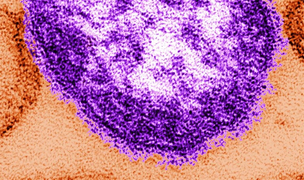 In den USA wurden seit Anfang des Jahres fast 1000 Masern-Fälle gemeldet.