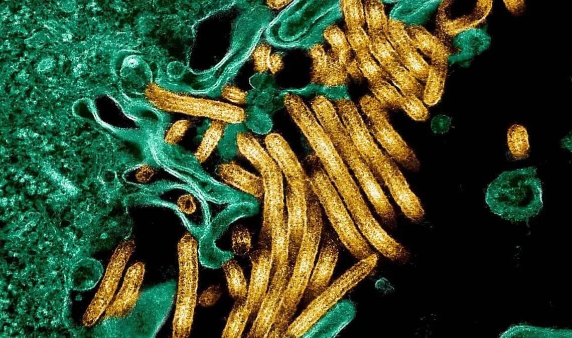 Kolorierte Aufnahme von Ebolaviren mit dem Elektronenmikroskop.