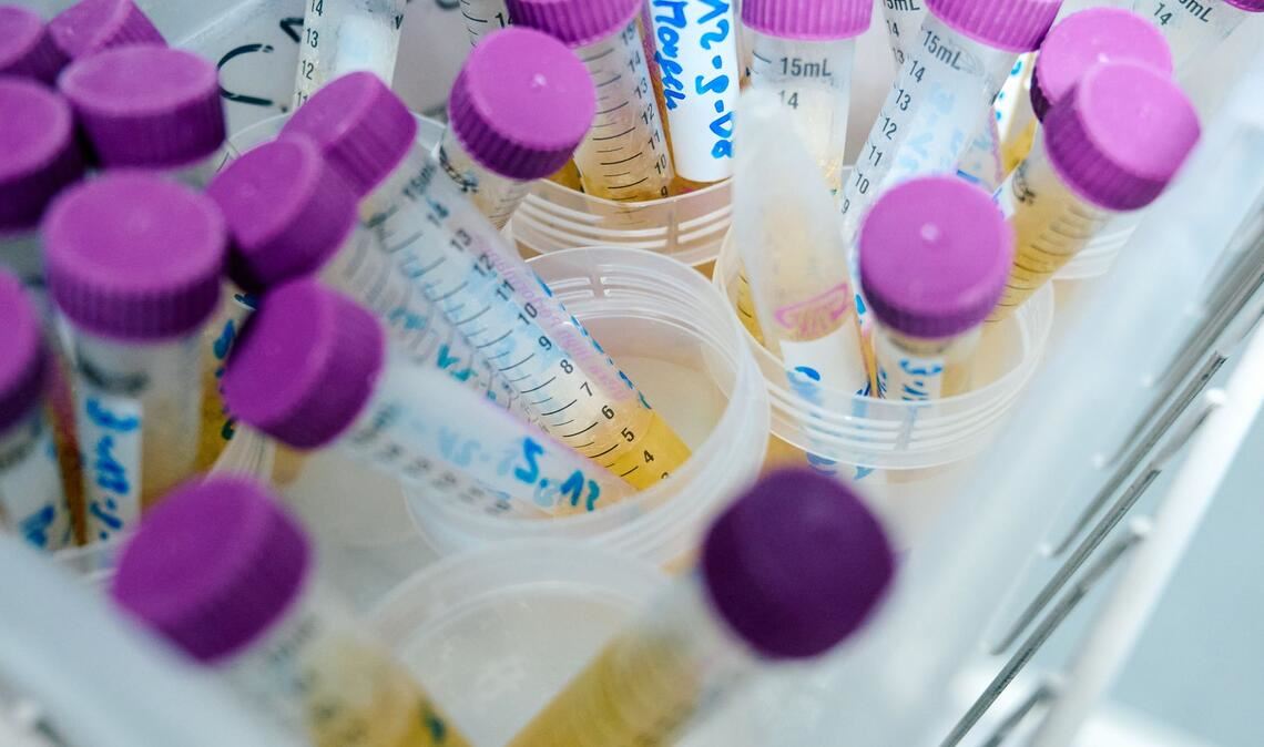 MnHexP ist ein Abbauprodukt des Weichmachers Di-n-hexylphthalat (DnHexP), der als fortpflanzungsschädigend gilt. (Symbolbild)