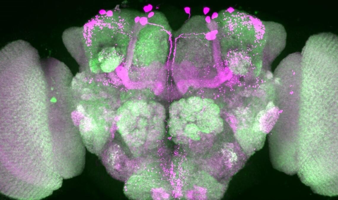 Nervenzellen im Gehirn einer Taufliege wurden durch Forscher pink eingefärbt, Nervenzellenverbindungen sind grün dargestellt.