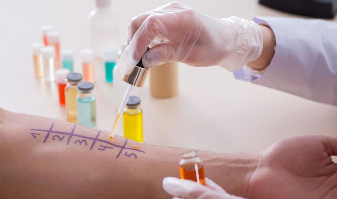 Ob eine Allergie vorliegt, kann der Arzt mit verschiedenen Tests untersuchen.