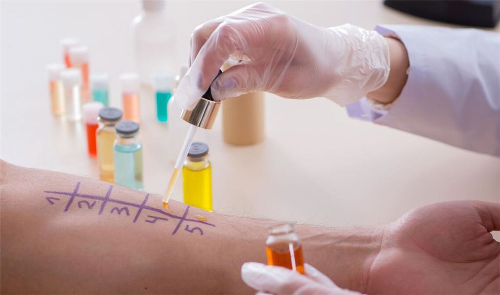 Ob eine Allergie vorliegt, kann der Arzt mit verschiedenen Tests untersuchen.