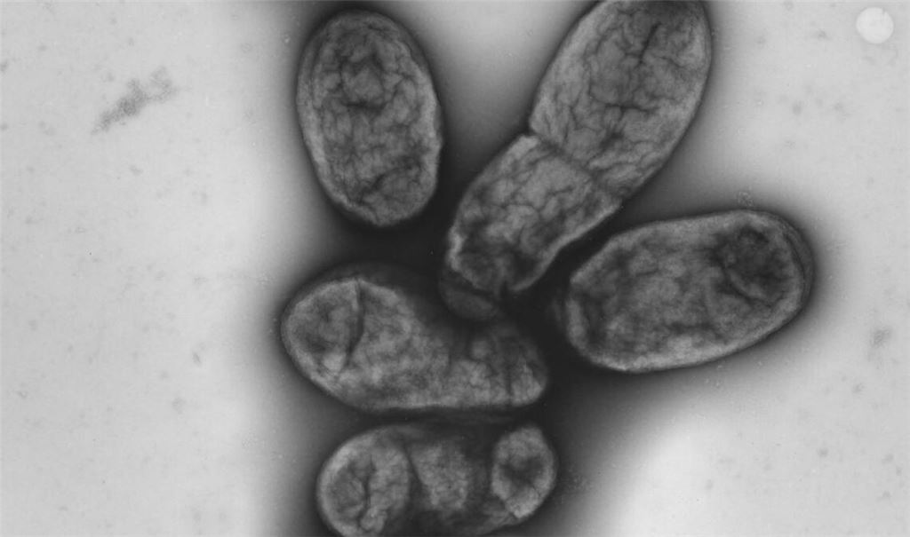Pesterreger Yersinia Pestis.