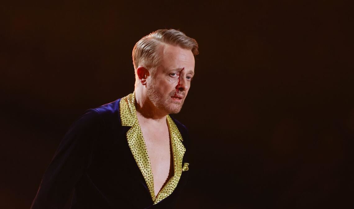 Ross Antony tanzt in der RTL-Tanzshow „Let's Dance“ im Coloneum und hat sich eine blutende Wunde zugezogen.