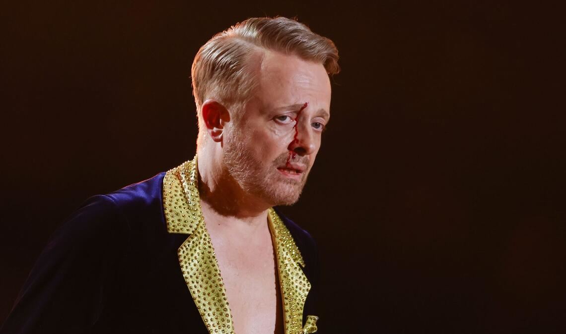 Ross Antony war sichtlich gezeichnet, nahm die Sache aber mit Humor.