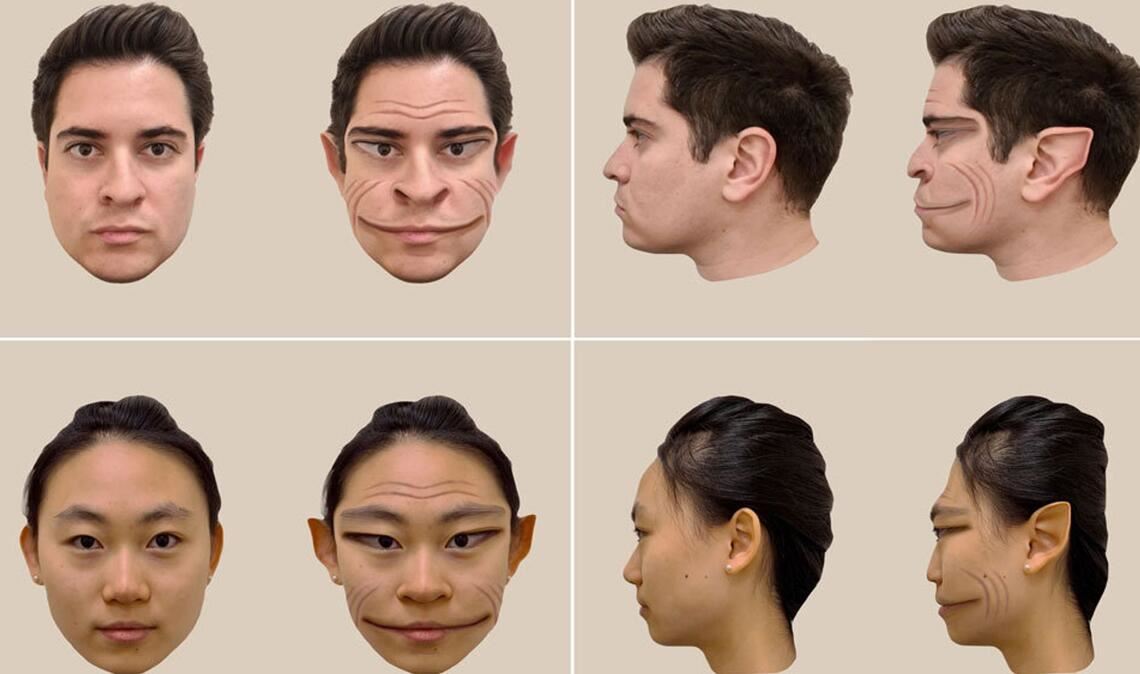 So dämonisch verzerrt nimmt ein 58-jähriger Amerikaner, der an der äußert seltenen Nervenerkrankung Prosopometamorphopsie leidet, die Gesichter anderer Menschen wahr.