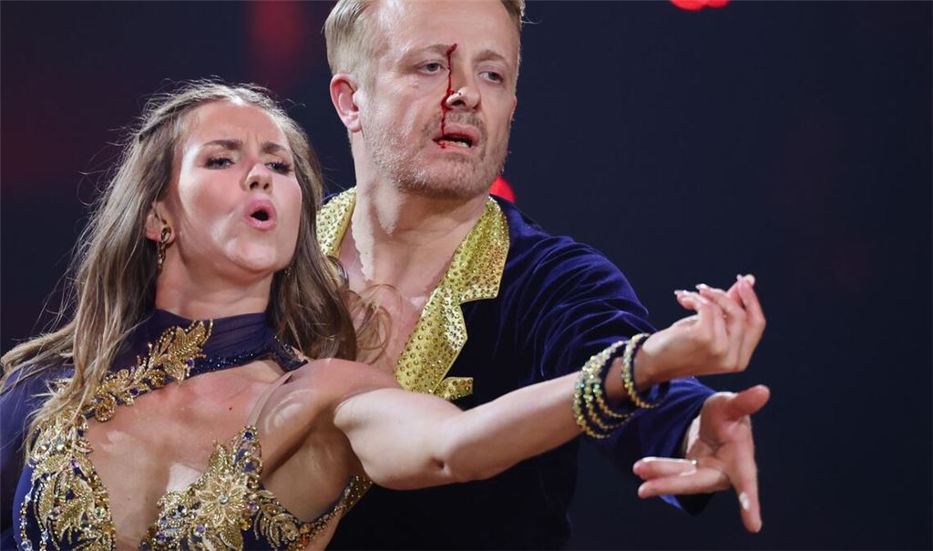 Tapfer tanzte Ross Antony weiter - trotz seiner Verletzung.