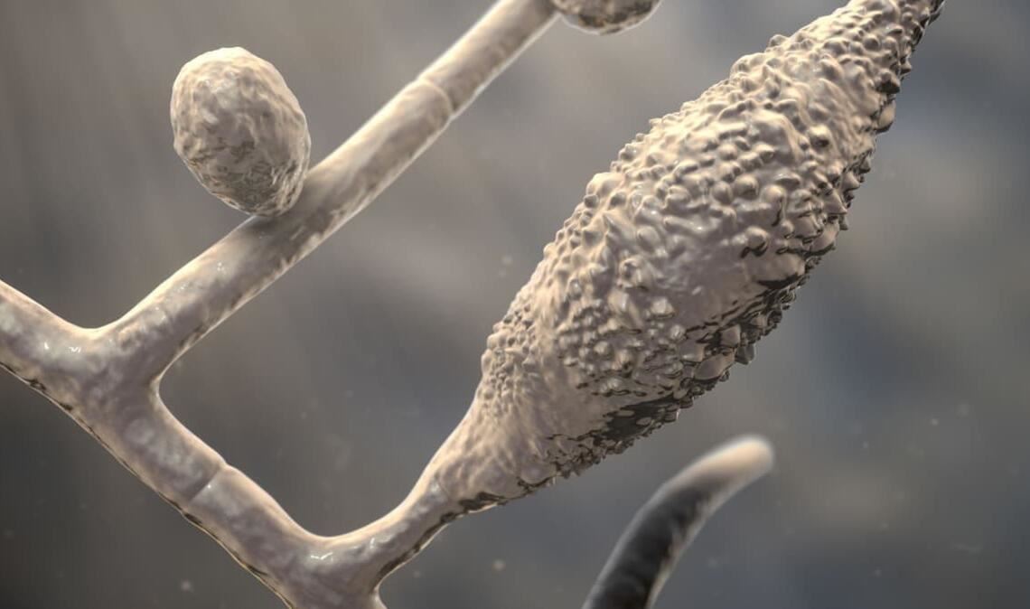 Tinea capitis in einer 3D-Illustration.