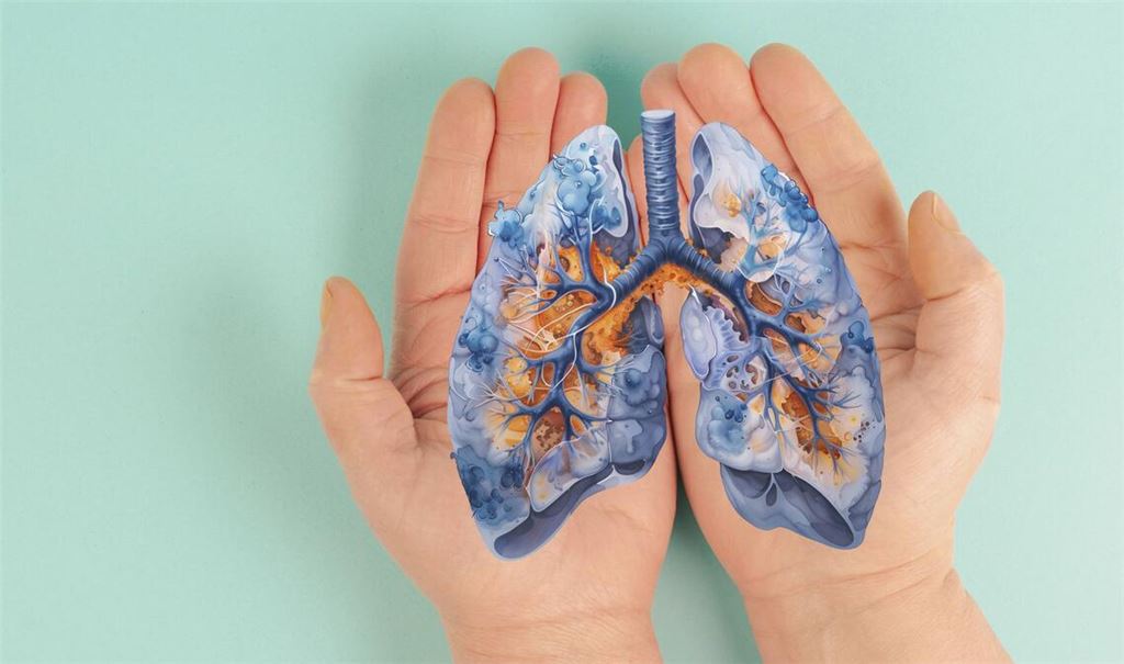 Virale Atemwegsinfektionen wie Grippe oder Covid-19 können gestreute Krebszellen in der Lunge reaktivieren und dadurch die Metastasenbildung fördern.