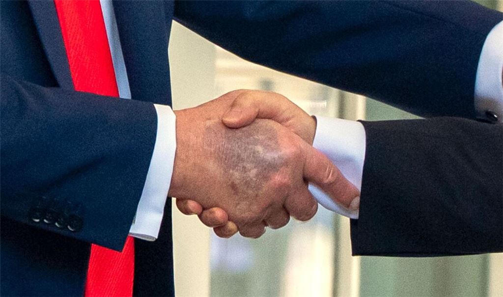 Zu sehen beim Händedruck mit dem südkoreanischen Präsidenten Lee: ein Bluterguss auf Trumps rechter Hand.