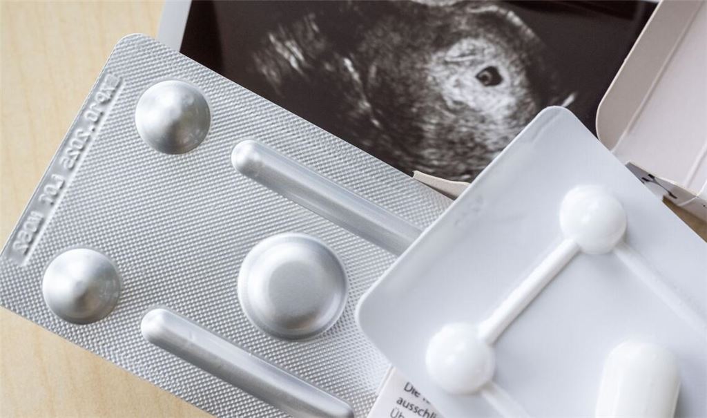 Zum ersten Mal wurde bei Schwangerschaftsabbrüchen das Medikament Mifegyne häufiger genutzt als die Absaugmethode. (Archivbild)